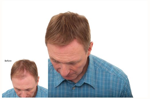 Nanogen Hair Thickening fibres 15gm - Image 4